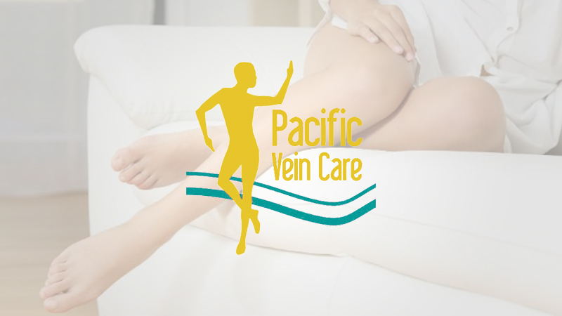 Pacific Vein Care featured image